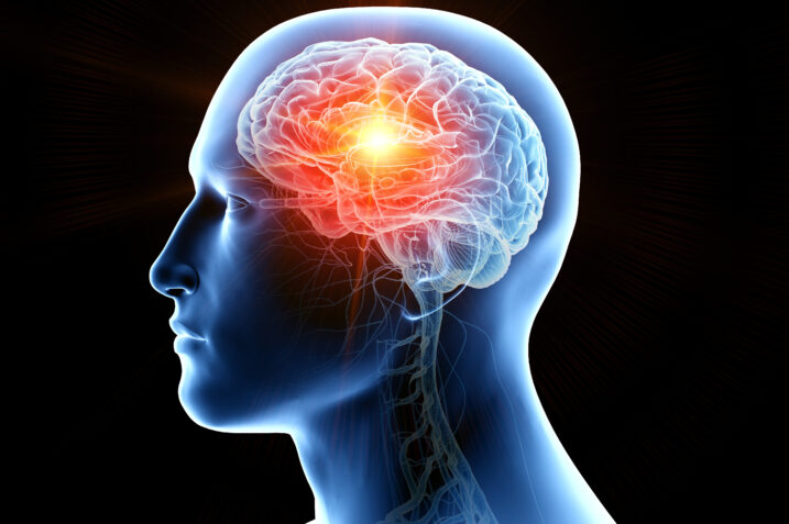 Avresti mai pensato che l'attività fisica ha queste ripercussioni sul nostro cervello?