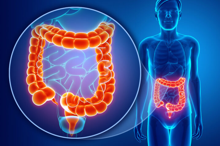 Colon irritabile e possibili interazioni a livello psicologico. Cosa dice la scienza