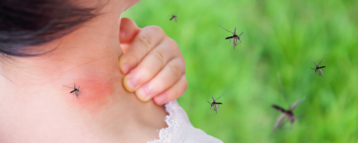 Stagione delle zanzare in arrivo: i trucchi naturali per risparmiarci punture 