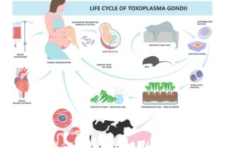 Toxoplasmosi: cause, rischi per la salute e come prevenire l’infezione