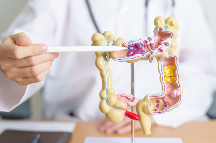 Quanto tempo occorre per digerire i cibi? Ecco cosa lo determina